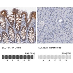 MCT1/SLC16A1 Antibody, Novus Biologicals:Antibodies:Primary Antibodies