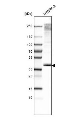 MCT1/SLC16A1 Antibody, Novus Biologicals:Antibodies:Primary Antibodies