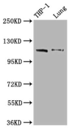 MDA5 Antibody (3D12), Novus Biologicals 100 &mu;g | Buy Online | Novus Biologicals | Fisher Scientific