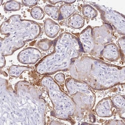 MDFI Antibody, Novus Biologicals:Antibodies:Primary Antibodies