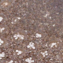 MDFIC Antibody, Novus Biologicals 0.1mL; Unlabeled:Antibodies, Polyclonal