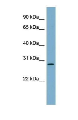MDG1 Antibody, Novus Biologicals 0.05mg; Unlabeled:Antibodies, Polyclonal