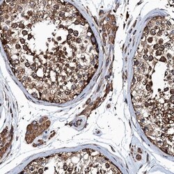 MDM1 Antibody, Novus Biologicals 0.1mL; Unlabeled:Antibodies, Polyclonal