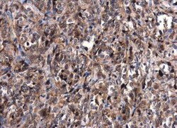 MDM2/HDM2 Antibody, Novus Biologicals 0.1mL; Unlabeled:Antibodies, Polyclonal