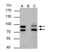 MDM2/HDM2 Antibody, Novus Biologicals 0.1mL; Unlabeled:Antibodies, Polyclonal