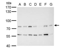 MDM2/HDM2 Antibody, Novus Biologicals 0.1mL; Unlabeled:Antibodies, Polyclonal