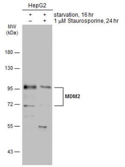 MDM2/HDM2 Antibody, Novus Biologicals 0.1mL; Unlabeled:Antibodies, Polyclonal