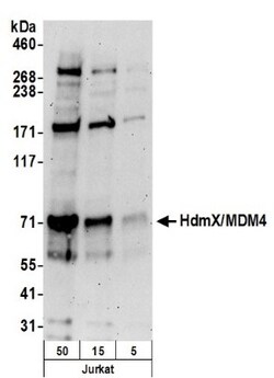 MDMX Antibody, Novus Biologicals 0.1mg; Unlabeled:Anticorps, Polyclonal
