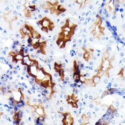 MDR1/ABCB1 Rabbit anti-Human, Mouse, Rat, Clone: 2U4E9, Novus Biologicals
