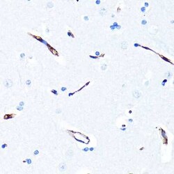 MDR1/ABCB1 Rabbit anti-Human, Mouse, Rat, Clone: 2U4E9, Novus Biologicals