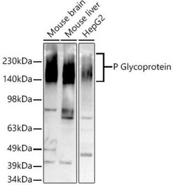 MDR1/ABCB1 Rabbit anti-Human, Mouse, Rat, Clone: 2U4E9, Novus Biologicals