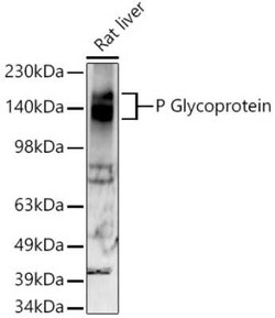 MDR1/ABCB1 Rabbit anti-Human, Mouse, Rat, Clone: 2U4E9, Novus Biologicals