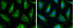 MDR1/ABCB1 Antibody, Novus Biologicals 0.1mL; Unlabeled:Antibodies, Polyclonal