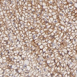 MDR1/ABCB1 Antibody, Novus Biologicals 0.1mL; Unlabeled:Antibodies, Polyclonal