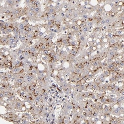 MDR1/ABCB1 Antibody, Novus Biologicals 0.1mL; Unlabeled:Antibodies, Polyclonal