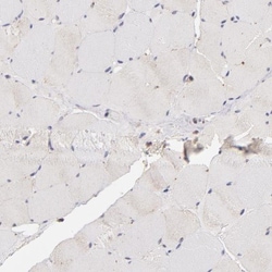 MDR1/ABCB1 Antibody, Novus Biologicals 0.1mL; Unlabeled:Antibodies, Polyclonal