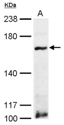 MDR1/ABCB1 Antibody, Novus Biologicals 0.1mL; Unlabeled:Antibodies, Polyclonal