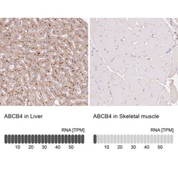 MDR3/ABCB4 Antibody, Novus Biologicals:Antibodies:Primary Antibodies