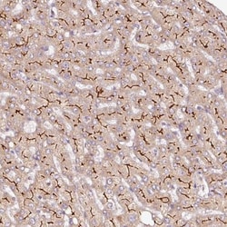 MDR3/ABCB4 Antibody, Novus Biologicals:Antibodies:Primary Antibodies