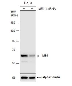 ME1 Antibody (15611), Novus Biologicals 0.1mL; Unlabeled:Antibodies, Monoclonal