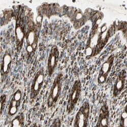 ME2 Antibody, Novus Biologicals 0.1mL; Unlabeled:Antibodies, Polyclonal