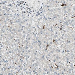 ME2 Antibody, Novus Biologicals 0.1mL; Unlabeled:Antibodies, Polyclonal