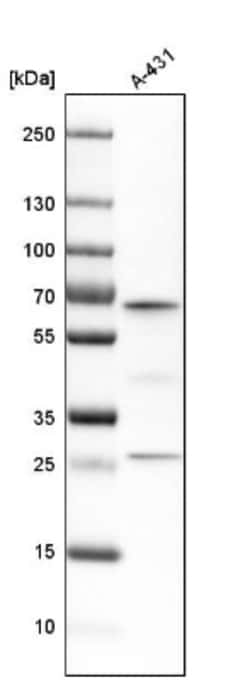 ME2 Antibody, Novus Biologicals:Antibodies:Primary Antibodies