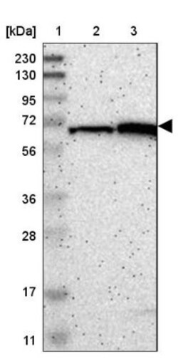 ME2 Antibody, Novus Biologicals 0.1mL; Unlabeled:Antibodies, Polyclonal