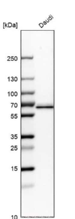 ME2 Antibody, Novus Biologicals 0.1mL; Unlabeled:Antibodies, Polyclonal