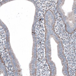 ME3 Antibody, Novus Biologicals 25 &mu;L | Buy Online | Novus Biologicals | Fisher Scientific