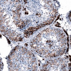 ME3 Antibody, Novus Biologicals 25 &mu;L | Buy Online | Novus Biologicals | Fisher Scientific