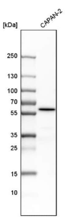 ME3 Antibody, Novus Biologicals 25 &mu;L | Buy Online | Novus Biologicals | Fisher Scientific