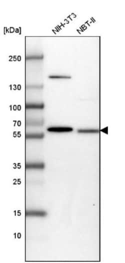 ME3 Antibody, Novus Biologicals 25 &mu;L | Buy Online | Novus Biologicals | Fisher Scientific