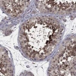 MEA-1 Rabbit anti-Human, Polyclonal, Novus Biologicals:Antibodies:Primary