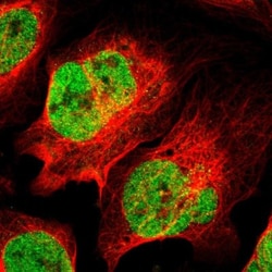 RANK/TNFRSF11A Antibody, Novus Biologicals:Antibodies:Primary Antibodies