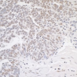 MED12 Antibody, Novus Biologicals 100 &mu;L | Buy Online | Novus Biologicals | Fisher Scientific