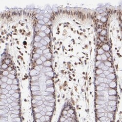 RANK/TNFRSF11A Antibody, Novus Biologicals:Antibodies:Primary Antibodies