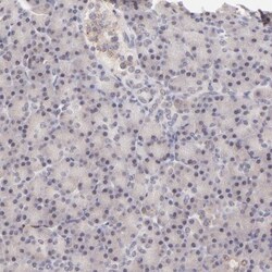RANK/TNFRSF11A Antibody, Novus Biologicals:Antibodies:Primary Antibodies