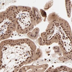 RANK/TNFRSF11A Antibody, Novus Biologicals:Antibodies:Primary Antibodies