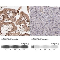 RANK/TNFRSF11A Antibody, Novus Biologicals:Antibodies:Primary Antibodies