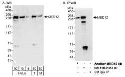 MED12 Antibody, Novus Biologicals 100 &mu;L | Buy Online | Novus Biologicals | Fisher Scientific