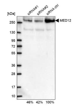 RANK/TNFRSF11A Antibody, Novus Biologicals:Antibodies:Primary Antibodies