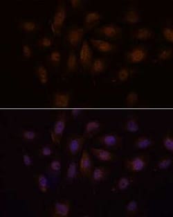 MED15 Rabbit anti-Human, Mouse, Rat, Polyclonal, Novus Biologicals 100