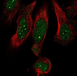 MED19 Antibody, Novus Biologicals 0.1mL; Unlabeled:Antibodies, Polyclonal