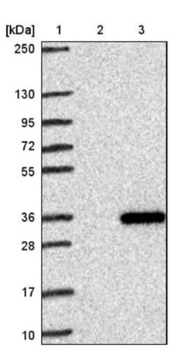 MED19 Antibody, Novus Biologicals 0.1mL; Unlabeled:Antibodies, Polyclonal