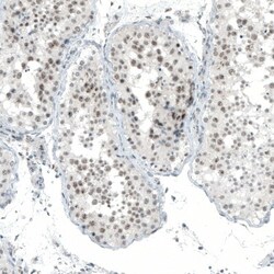 MED20 Antibody, Novus Biologicals:Antibodies:Primary Antibodies