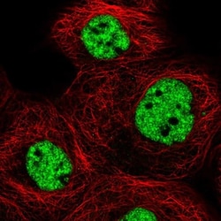 MED6 Antibody, Novus Biologicals:Antibodies:Primary Antibodies