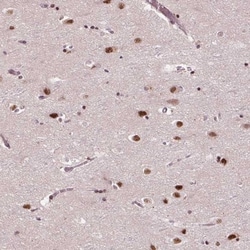 MED6 Antibody, Novus Biologicals:Antibodies:Primary Antibodies