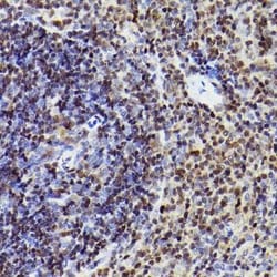MEF2A/C Rabbit anti-Human, Mouse, Clone: 10I9G9, Novus Biologicals 100