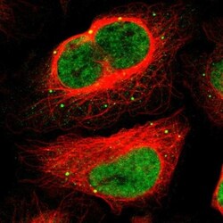 MEF2D Antibody, Novus Biologicals:Antibodies:Primary Antibodies